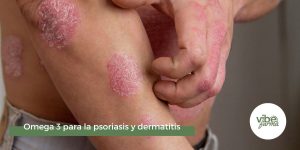 omega 3 psoriasis y dermatitis